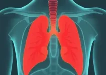 tuberculose